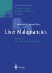 book Liver Malignancies: Diagnostic and Interventional Radiology