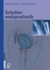 book Schulterendoprothetik: Indikation, Implantate, OP-Technik, Nachbehandlung, Begutachtung