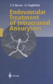 book Endovascular Treatment of Intracranial Aneurysms