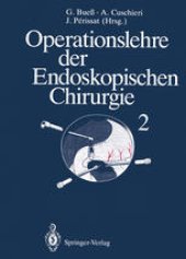 book Operationslehre der Endoskopischen Chirurgie: Band 2