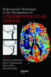 book Endovascular Techniques in the Management of Cerebrovascular Disease