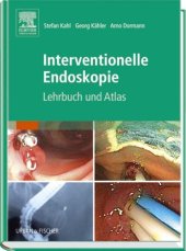 book Interventionelle Endoskopie