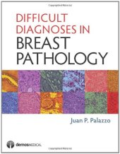 book Difficult Diagnoses in Breast Pathology