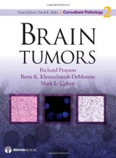 book Brain Tumors