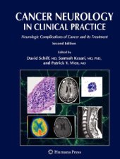book Cancer Neurology in Clinical Practice; Neurologic Complications of Cancer and Its Treatment