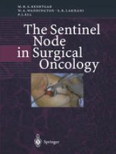 book The Sentinel Node in Surgical Oncology