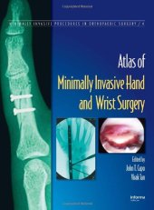 book atlas of minimal invasive hand and wrist surgery