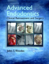 book Advanced Endodontics