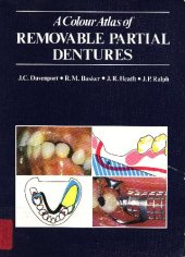 book A Colour Atlas of Removable Partial Dentures