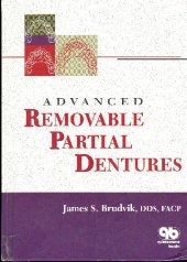 book Advanced Removable Partial Dentures