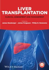 book Liver Transplantation: Clinical Assessment and Management