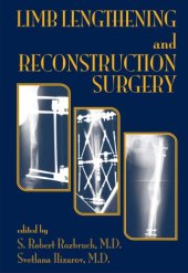 book Limb Lengthening and Reconstruction Surgery