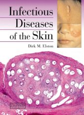 book Infectious Diseases of the Skin