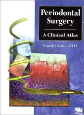 book periodontal surgery