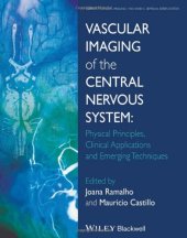 book Vascular Imaging of the Central Nervous System: Physical Principles, Clinical Applications and Emerging Techniques