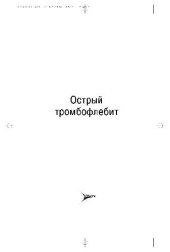 book Острый тромбофлебит