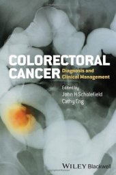 book Colorectal Cancer: Diagnosis and Clinical Management
