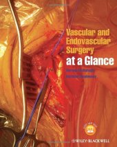 book Vascular and Endovascular Surgery at a Glance