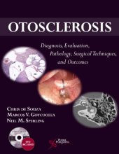 book Otosclerosis: Diagnosis, Evaluation, Pathology, Surgical Techniques, and Outcomes