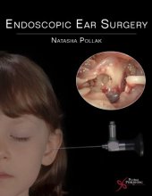 book Endoscopic Ear Surgery