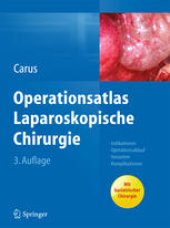 book Operationsatlas Laparoskopische Chirurgie