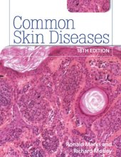 book Common Skin Diseases 18th edition