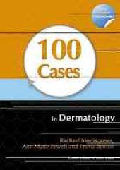 book 100 Cases in Dermatology