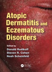 book Atopic Dermatitis and Eczematous Disorders