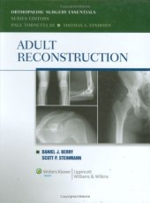 book Adult Reconstruction