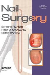 book Nail Surgery