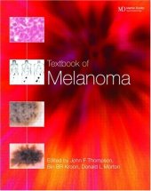 book Textbook of Melanoma: Pathology, Diagnosis and Management