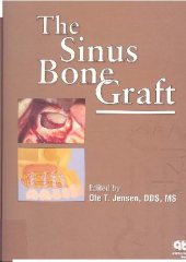 book The Sinus Bone Graft