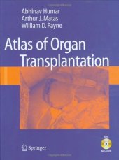 book Atlas of Organ Transplantation