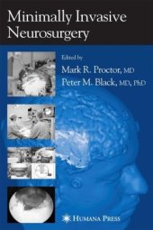 book Minimal Invasive Neurosurgery