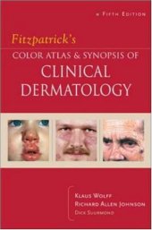 book Fitzpatrick's Color Atlas & Synopsis of Clinical Dermatology 