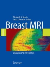 book Breast MRI: Diagnosis and Intervention