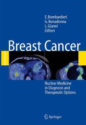 book Breast Cancer Nuclear Medicine in Diagnosis and Therapeutic Options