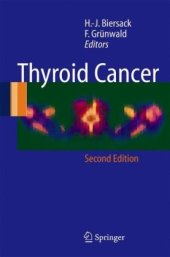 book Thyroid Cancer