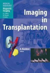book Imaging in Transplantation