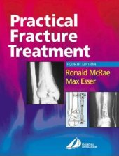 book Practical Fracture Treatment