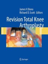 book Revision Total Knee Arthroplasty