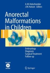 book Holschneider Anorectal Malformations in Children