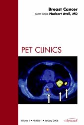 book Breast Cancer, An Issue of PET Clinics