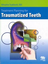 book Treatment Planning for Traumatized Teeth