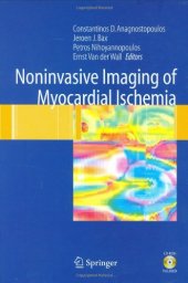 book Noninvasive Imaging of Myocardial Ischemia