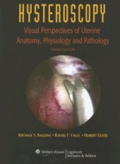 book Hysteroscopy: Visual Perspectives of Uterine Anatomy, Physiology, and Pathology