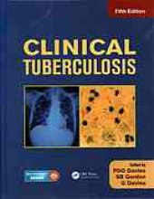 book Clinical Tuberculosis 4th Edition