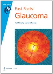 book Glaucoma