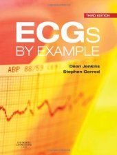 book ECGs by example