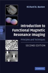 book Introduction to functional magnetic resonance imaging : principles and techniques